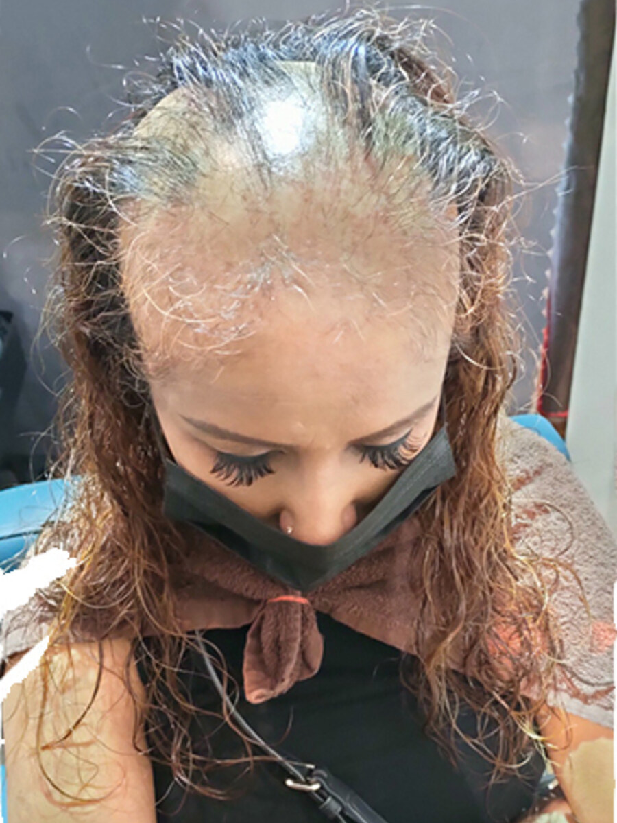 Client before Roots Care hair extensions