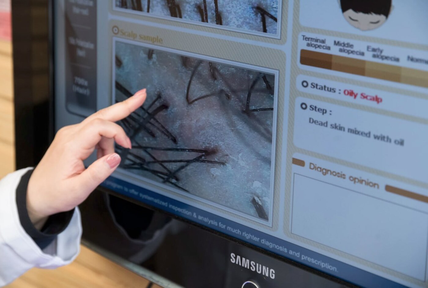 A Roots Care consultant reading a client’s hair follicle scan on the clinic monitor